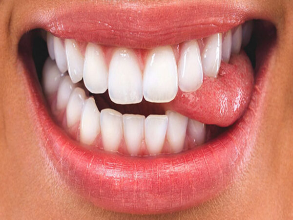 Điềm báo cắn vào lưỡi