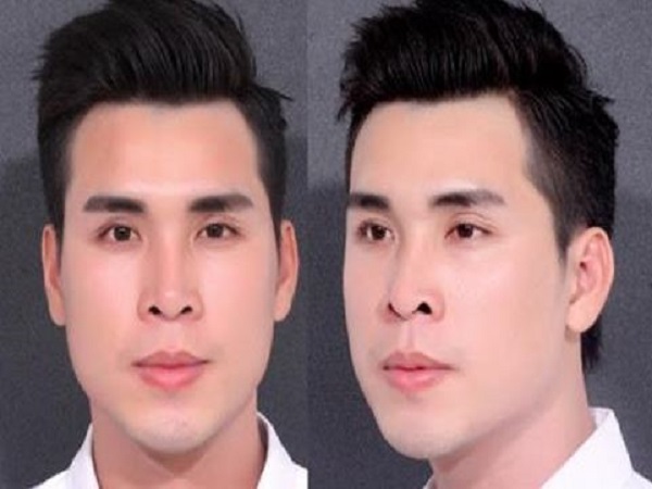 Ý nghĩa của tướng mặt ít lộc trong nhân tướng học